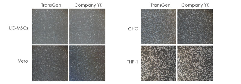 使用TransGen 凍存液和Company YK 無(wú)DMSO 無(wú)蛋白凍存液在-80℃凍存1 個(gè)月的多種細(xì)胞復(fù)蘇24 小時(shí)后細(xì)胞貼壁情況的比較